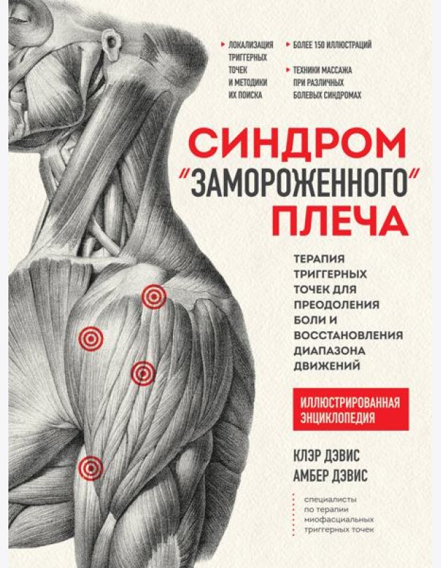 Синдром 