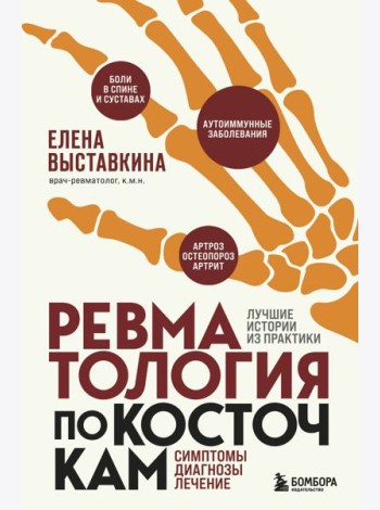 Ревматология по косточкам. Симптомы, диагнозы, лечение