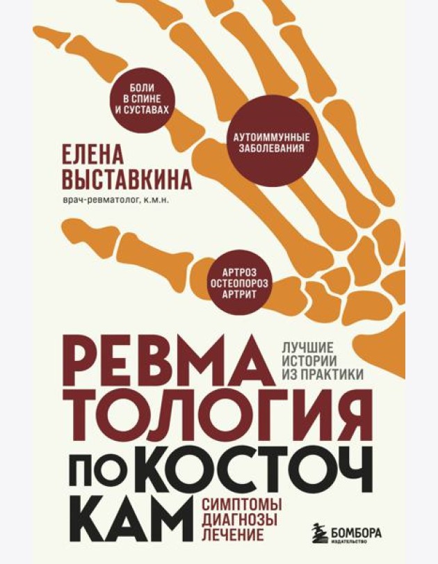 Ревматология по косточкам. Симптомы, диагнозы, лечение