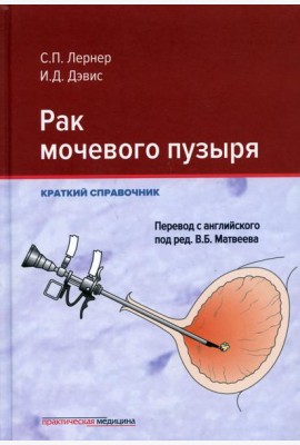 Рак мочевого пузыря. Краткий справочник