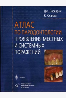 Атлас по пародонтологии. Проявления местных и системных поражений