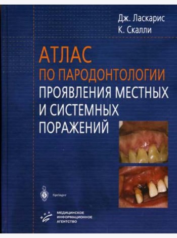 Атлас по пародонтологии. Проявления местных и системных поражений
