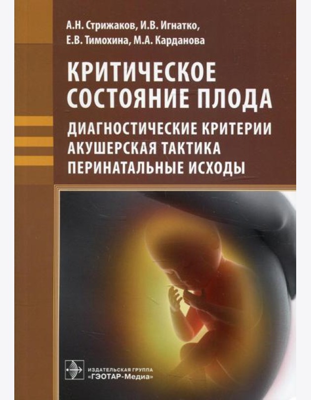 Критическое состояние плода: диагностические критерии, акушерская тактика, перинатальные исходы
