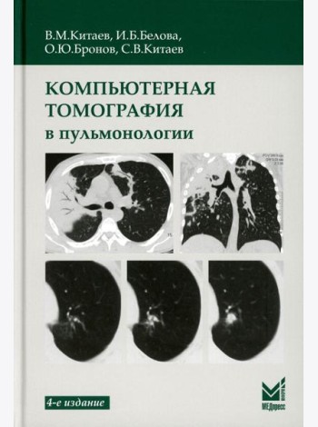Компьютерная томография в пульмонологии. 4-е изд