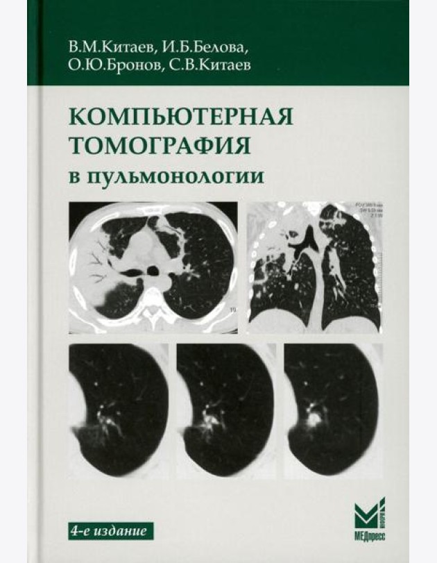 Компьютерная томография в пульмонологии. 4-е изд