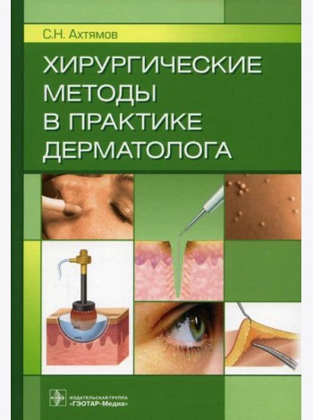 Хирургические методы в практике дерматолога