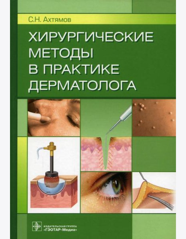 Хирургические методы в практике дерматолога