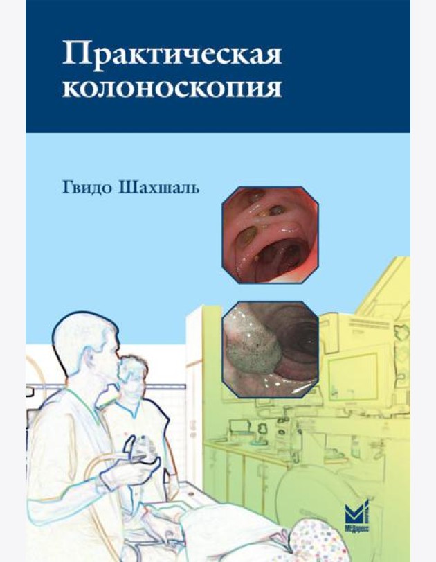 Практическая колоноскопия. Методика, рекомендации, советы и приемы. 3-е изд