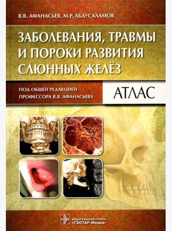 Заболевания, травмы и пороки развития слюнных желез: Атлас