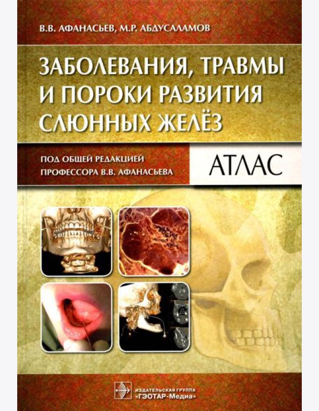 Заболевания, травмы и пороки развития слюнных желез: Атлас