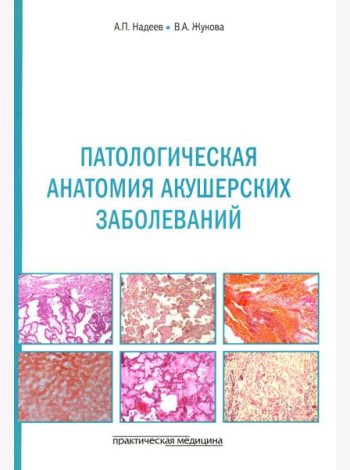 Патологическая анатомия акушерских заболеваний