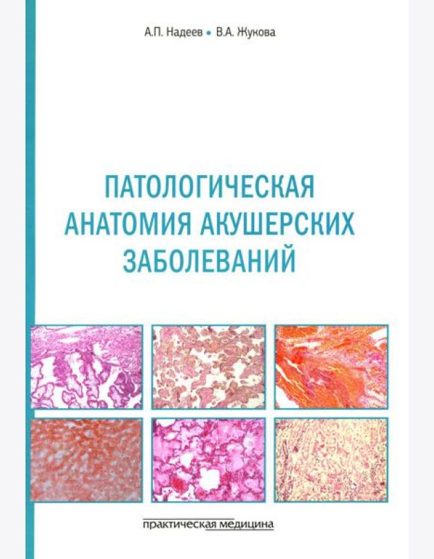 Патологическая анатомия акушерских заболеваний