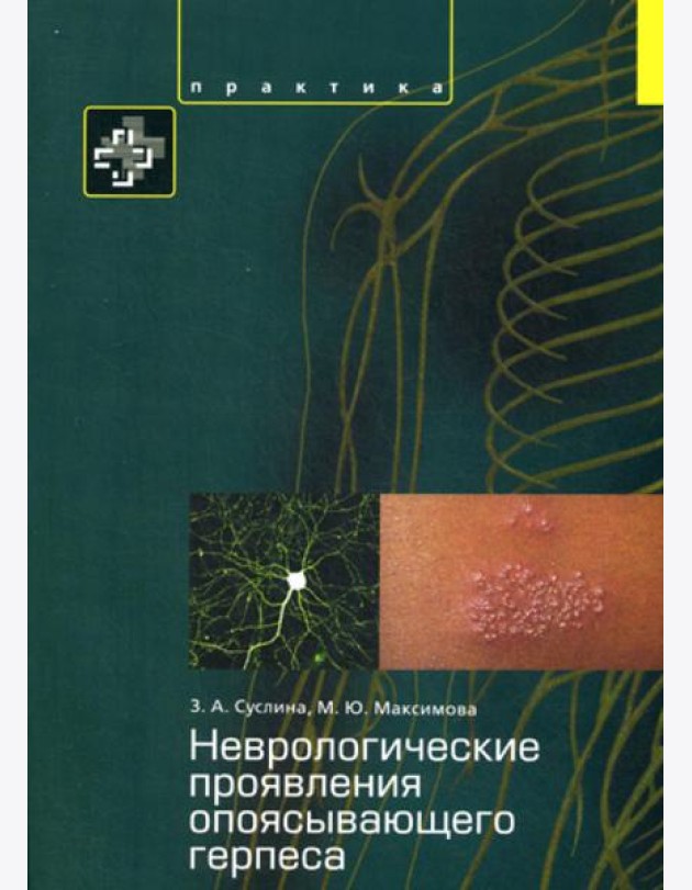Неврологические проявления опоясывающего герпеса. Пособие для врачей