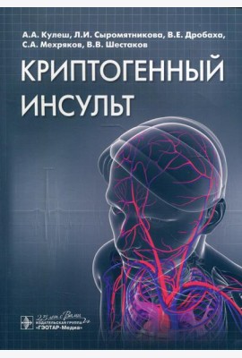 Криптогенный инсульт: руководство