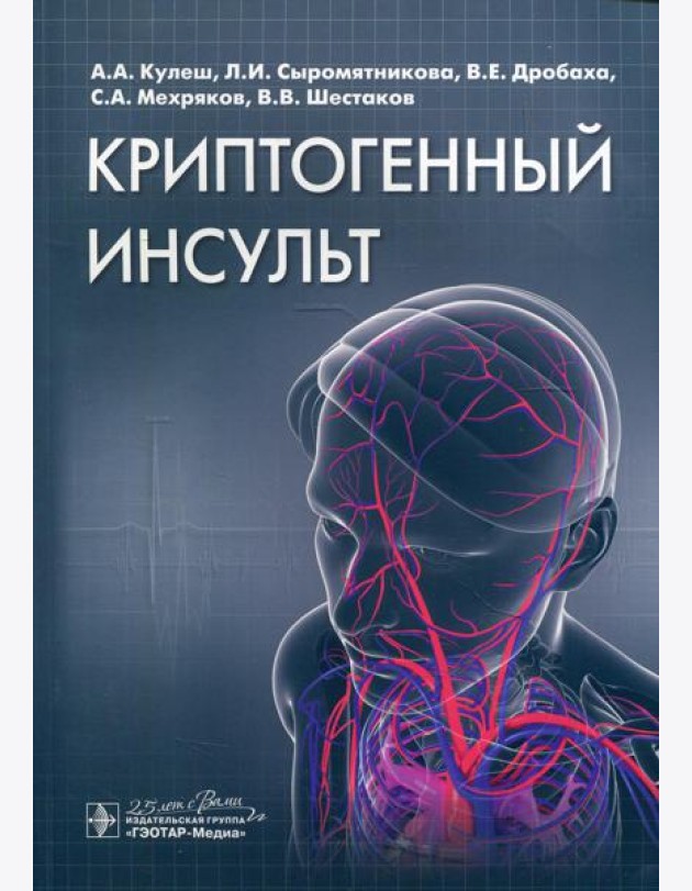 Криптогенный инсульт: руководство