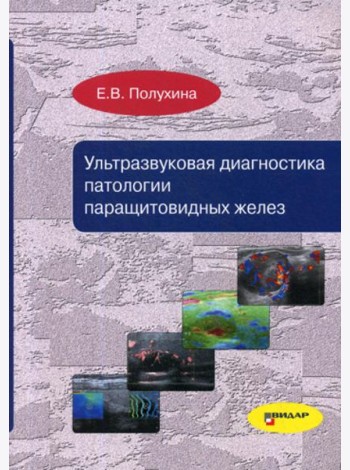 Ультразвуковая диагностика патологии паращитовидных желез