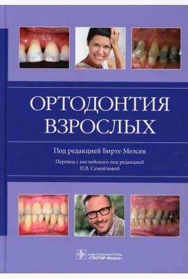 Ортодонтия взрослых