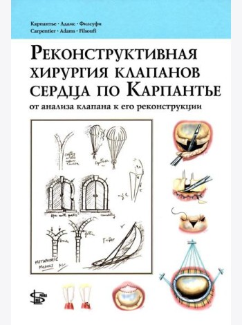 Реконструктивная хирургия клапанов сердца по Карпантье: от анализа клапана к его реконструкции