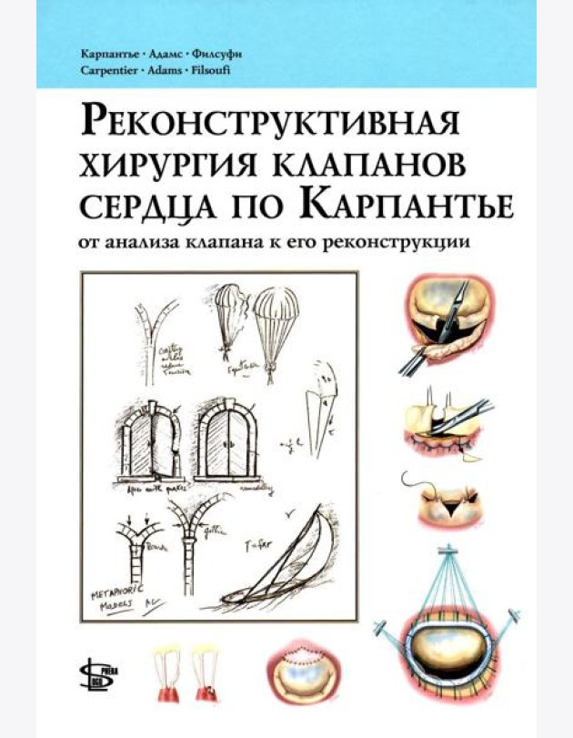 Реконструктивная хирургия клапанов сердца по Карпантье: от анализа клапана к его реконструкции