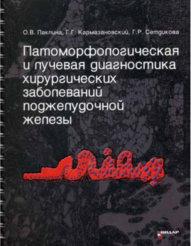 Патоморфологическая и лучевая диагностика хирургических заболеваний поджелудочной железы