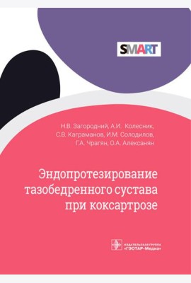 Эндопротезирование тазобедренного сустава при коксартрозе