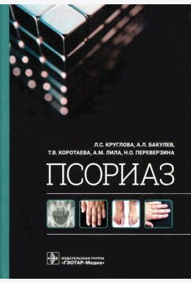 Псориаз
