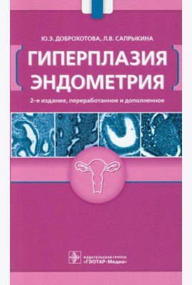 Гиперплазия эндометрия
