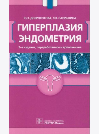 Гиперплазия эндометрия