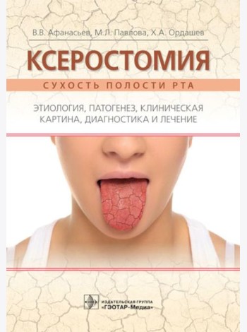 Ксеростомия. Сухость полости рта. Этиология, патогенез, клиническая картина, диагностика и лечение