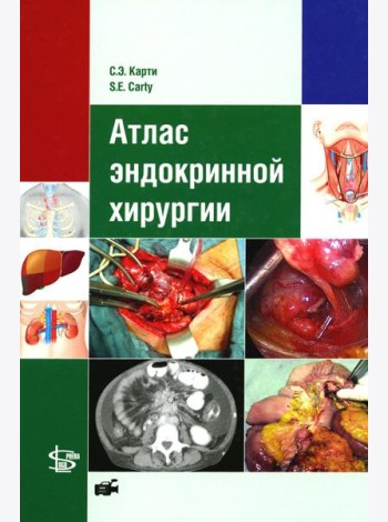 Атлас эндокринной хирургии