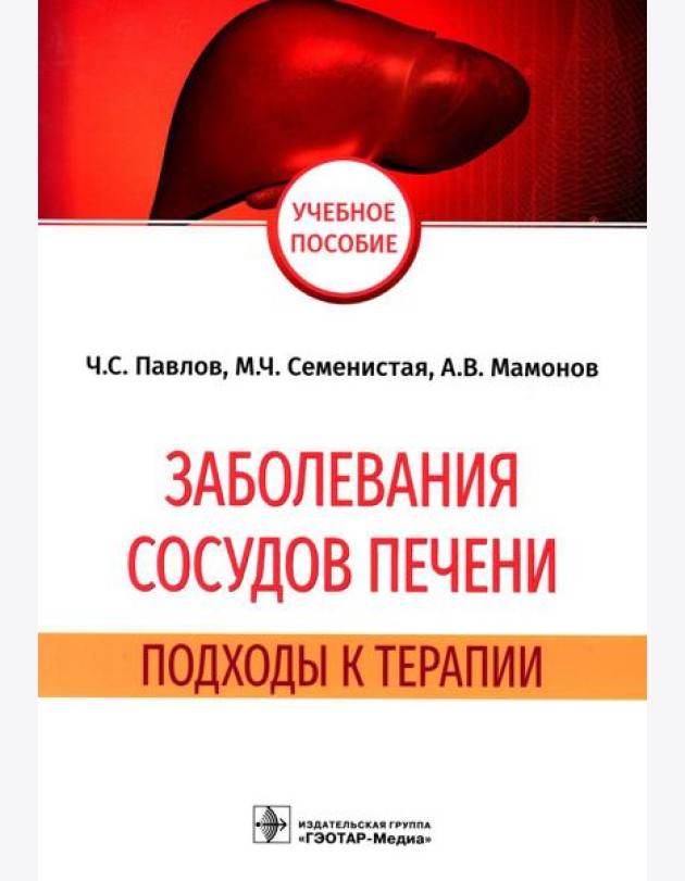Заболевания сосудов печени. Подходы к терапии