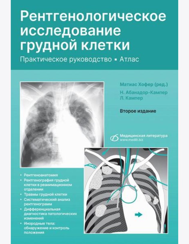 Рентгенологическое исследование грудной клетки. Практическое руководство. Атлас