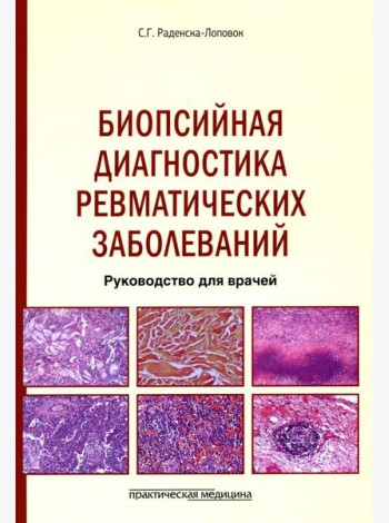 Биопсийная диагностика ревматических заболеваний. Руководство для врачей