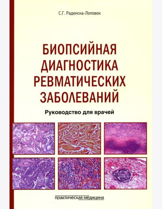 Биопсийная диагностика ревматических заболеваний. Руководство для врачей