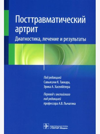 Посттравматический артрит. Диагностика, лечение и результаты
