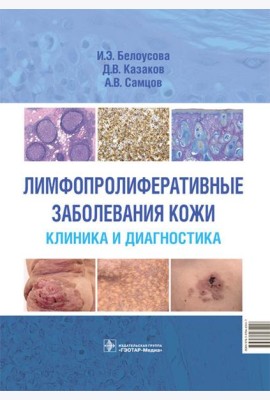 Лимфопролиферативные заболевания кожи. Клиника и диагностика