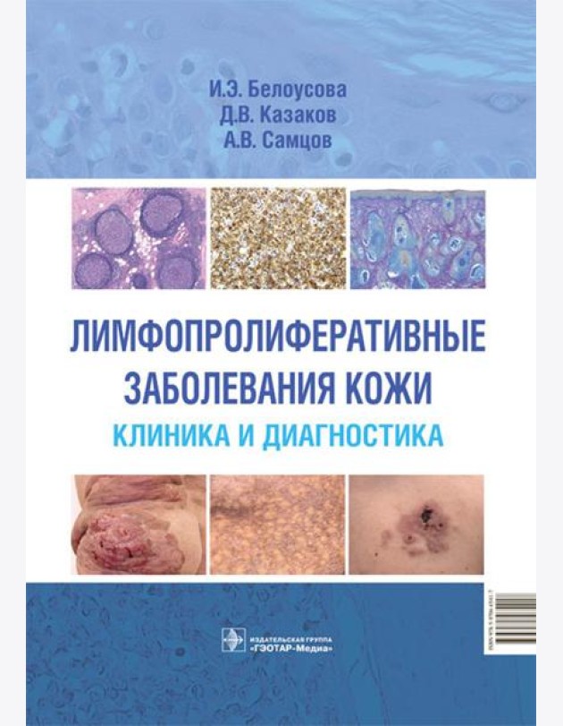 Лимфопролиферативные заболевания кожи. Клиника и диагностика
