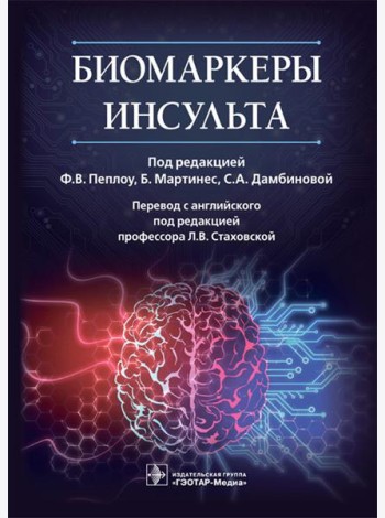 Биомаркеры инсульта