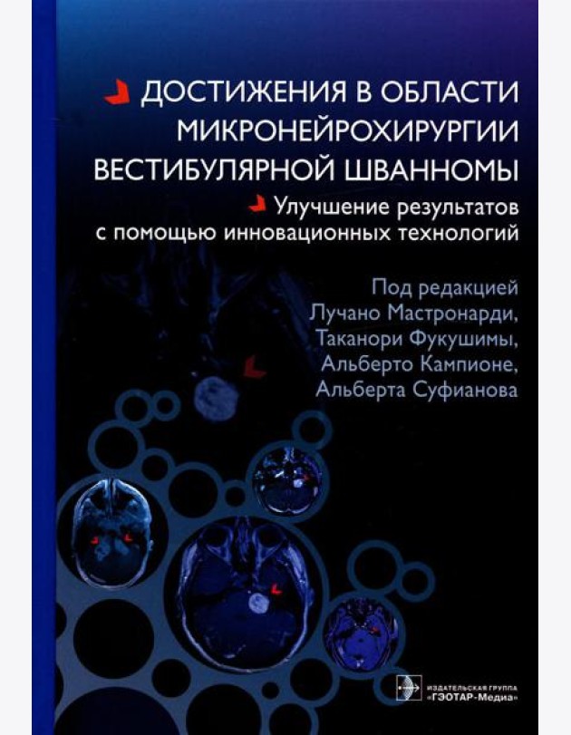 Достижения в области микронейрохирургии вестибулярной шванномы. Улучшение результатов с помощью инновационных технологий