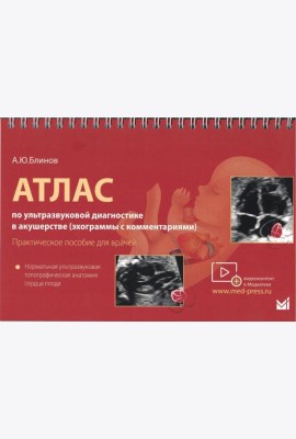 Атлас по УЗД в акушерстве. Нормальная ультразвуковая топографическая анатомия сердца плода: Практическое пособие для врачей