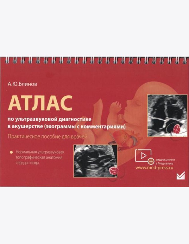 Атлас по УЗД в акушерстве. Нормальная ультразвуковая топографическая анатомия сердца плода: Практическое пособие для врачей