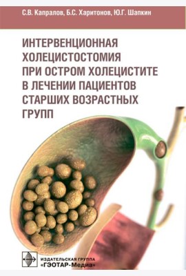 Интервенционная холецистостомия при остром холецистите в лечении пациентов старших возврастных групп