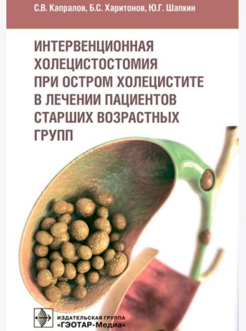 Интервенционная холецистостомия при остром холецистите в лечении пациентов старших возврастных групп