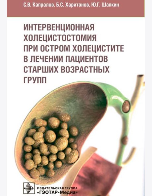 Интервенционная холецистостомия при остром холецистите в лечении пациентов старших возврастных групп