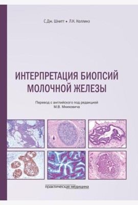 Интерпретация биопсий молочной железы