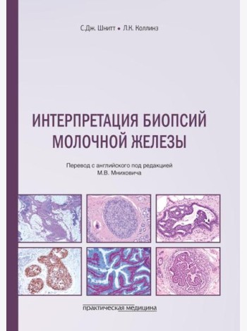 Интерпретация биопсий молочной железы