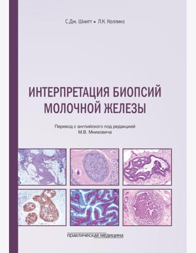 Интерпретация биопсий молочной железы