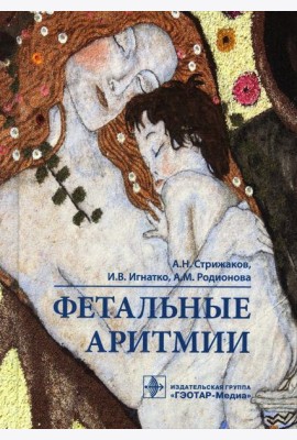 Фетальные аритмии