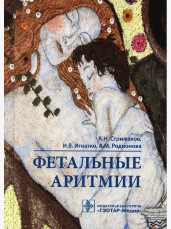 Фетальные аритмии