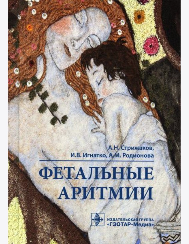 Фетальные аритмии